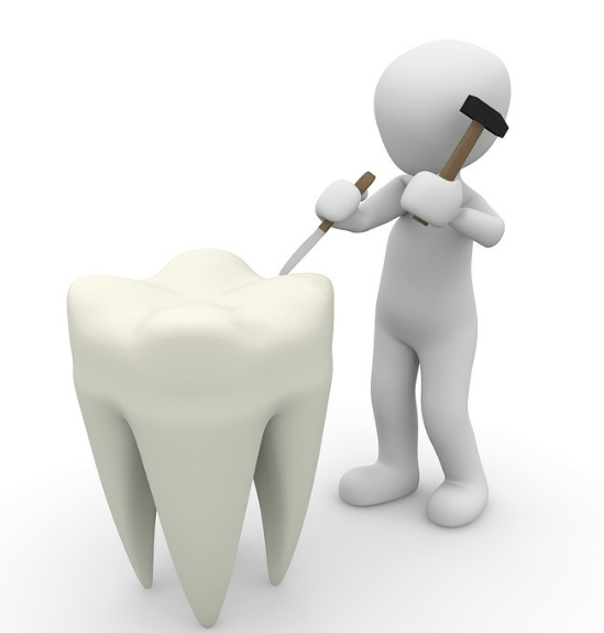 Caries Prevention Modalities 1 Skygate Dental Emergency Cavity
