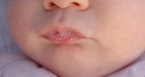 Importance of Saliva