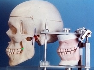 Skygate Dental Articulator