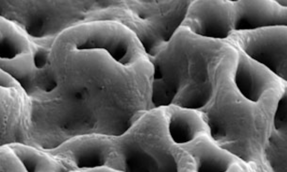Dental Implant Considerations 