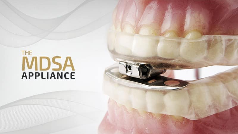 the mdsa appliance
