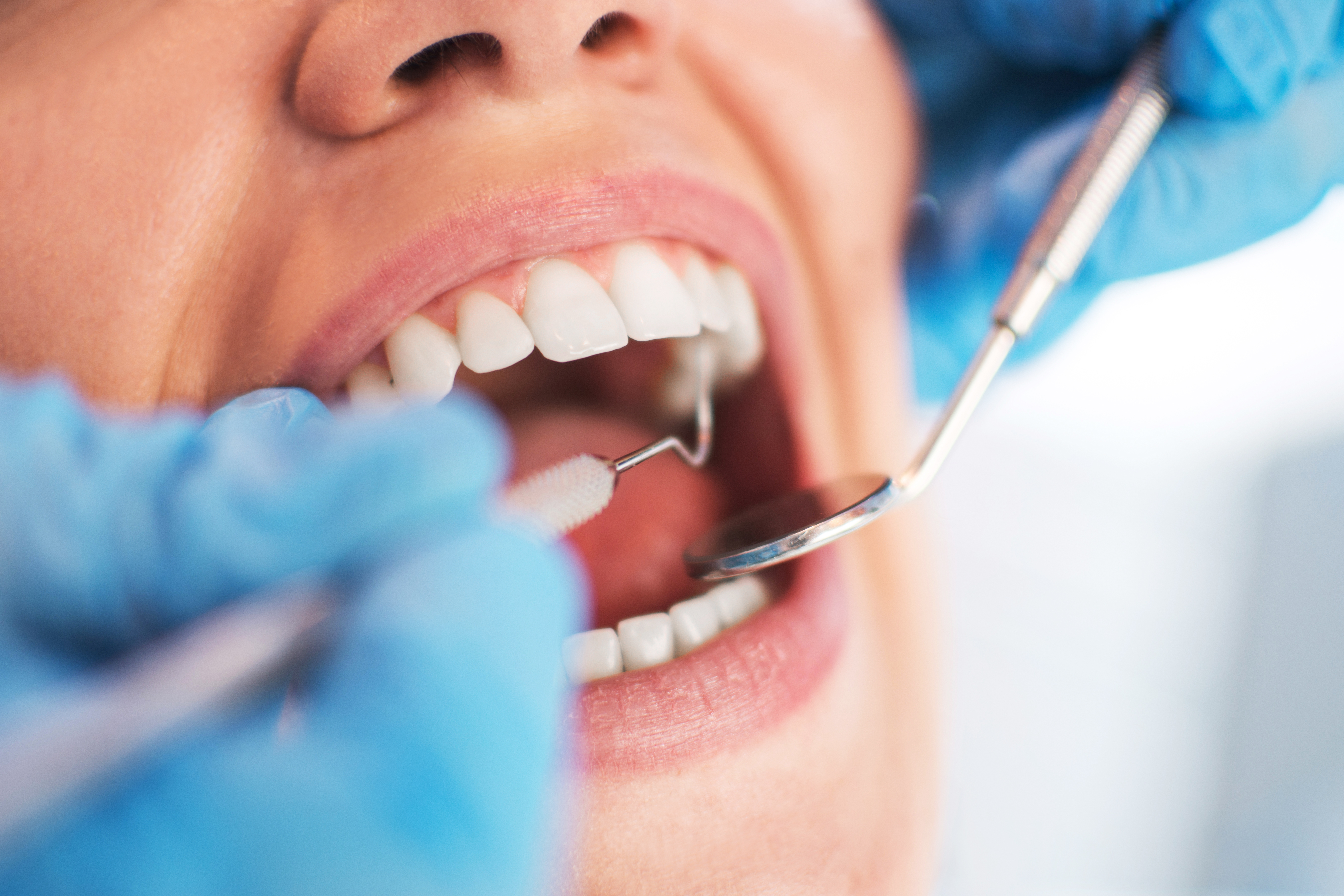 Open female mouth during oral checkup at the dentist. Selective 532170854